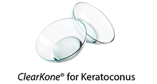 made-in-california-manufacturer-synergeyes-inc-clearkone